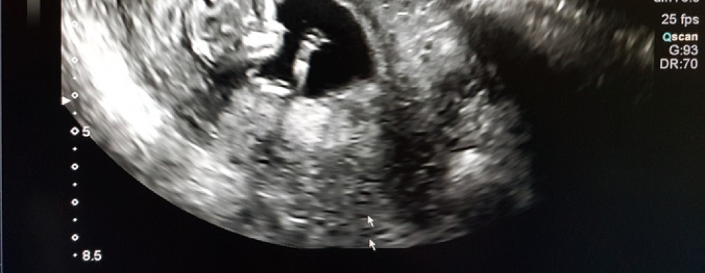 Wat is nu precies kwaliteit van leven (column)